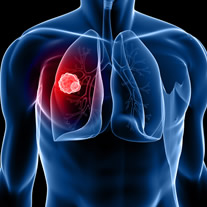 Cancer Immunology